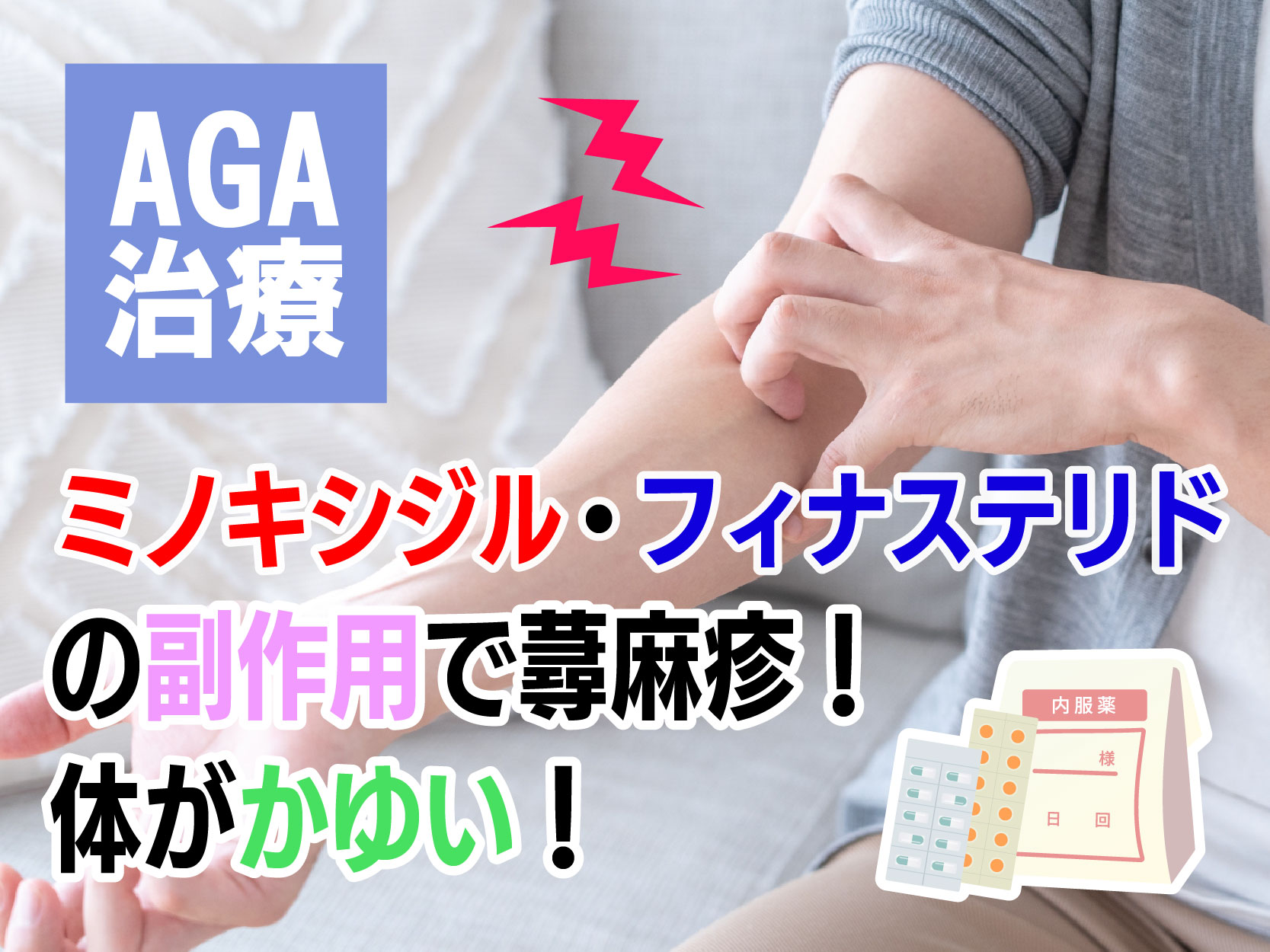 AGA治療ミノキシジル・フィナステリドの副作用で蕁麻疹